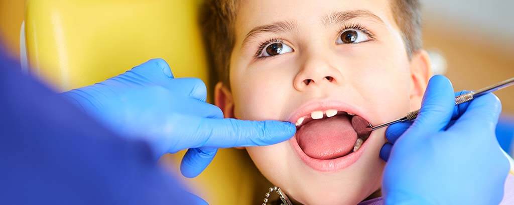 a dentist asks a child if he wants nitrous oxide for children